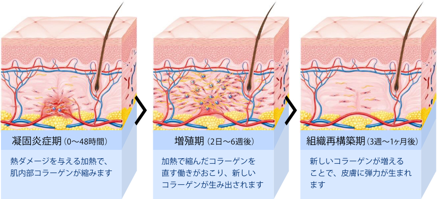 効果が出るまでの流れ